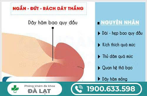 Hình ảnh minh họa